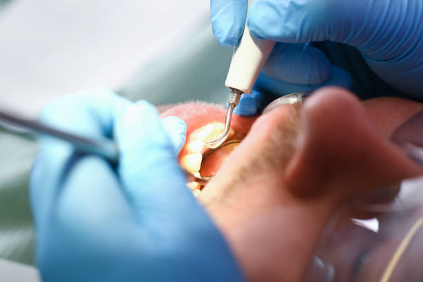 Best Tooth Infection Emergency Dentist  in Norwalk, OH