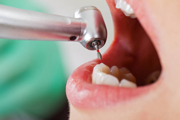 Best Dentist for Severe Toothache  in Norwalk, OH